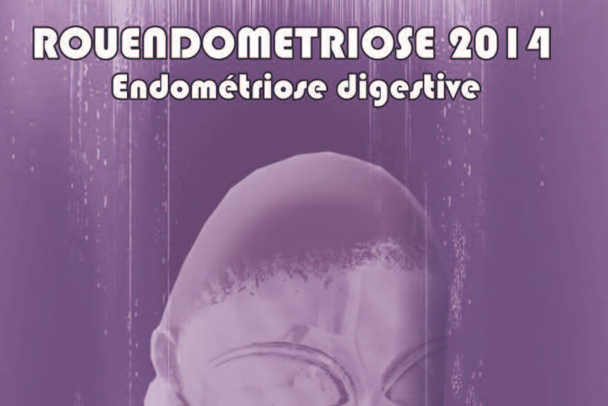 Endométriose digestive